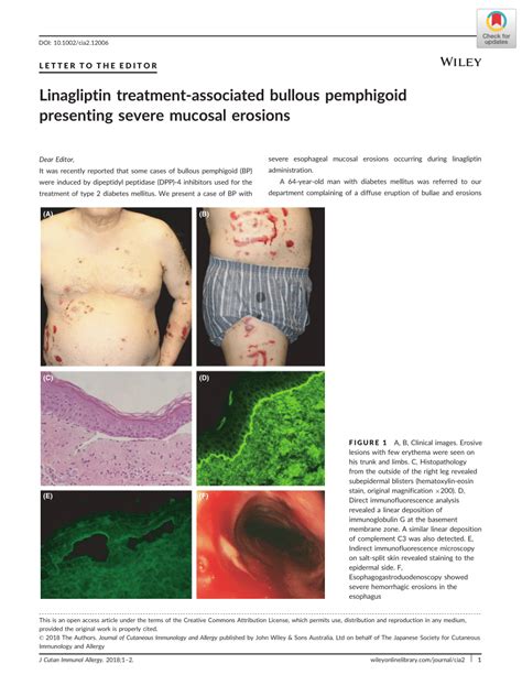 (PDF) Linagliptin treatment-associated bullous pemphigoid presenting severe mucosal erosions