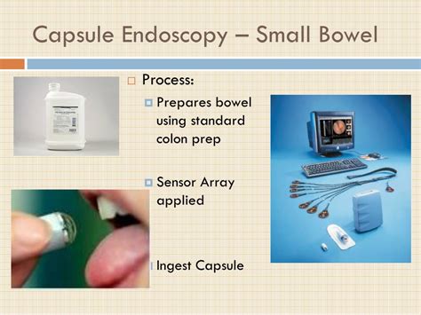 PPT - Capsule Endoscopy PowerPoint Presentation, free download - ID:4521276