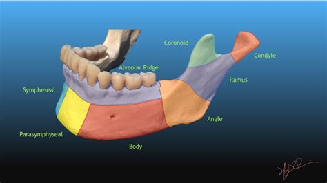 Dingman and Natvig Classification of Mandibular fractures | UW ...