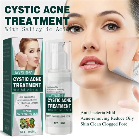 Cystic Acne Spot Treatment, Hormonal Acne Treatment for Face，Back and ...