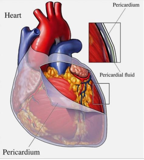 Pericardial Window Procedure Steps