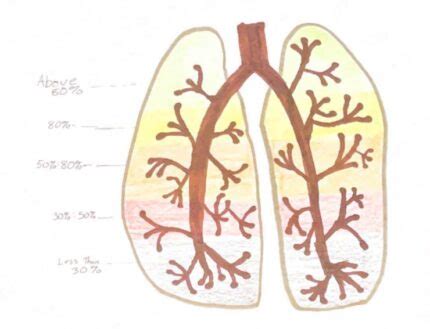 Stages of Emphysema – Human STEAM