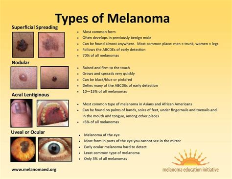 Pin on Melanoma ~ My war!