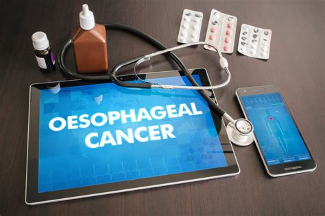 Oesophageal Cancer - Overview, Causes, Symptoms, Diagnosis, Treatment