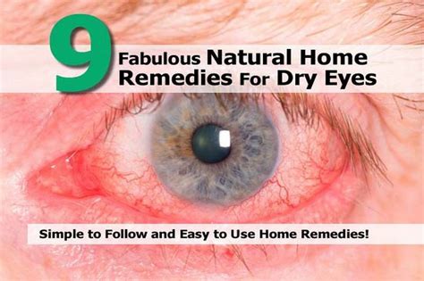 9 Fabulous Natural Home Remedies For Dry Eyes