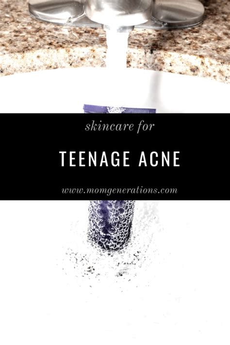 Best Acne Products for Teenage Guys - Stylish Life for Moms