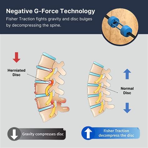 Fisher Traction Neck Pain & Headache Relief Device | Neck Traction for ...