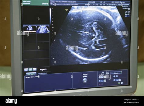 Pregnant woman ultrasound scan Stock Photo - Alamy