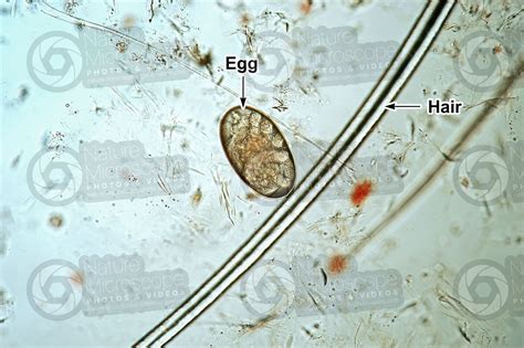 Demodex canis. Demodectic mange. 100X - Arachnida (Arachnids) - Ectoparasites - Parasitology ...