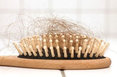 Nine Ways to Reduce and Treat Hair Loss (Without Medication) | Beauty and Personal Grooming