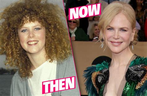 Nicole Kidman Plastic Surgery Photo Details