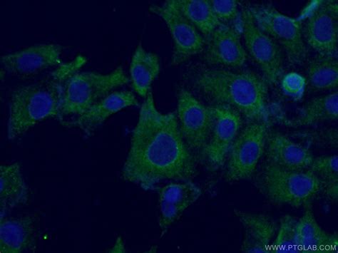 Fibrillin 1 Antibody 26935-1-AP | Proteintech