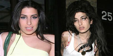 Amy Winehouse: The Before and After of Drugs and Alcohol | Newz