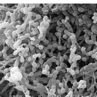 Scanning electron micrograph showing spore morphology of Streptomyces ...