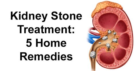 Kidney Stone Treatment: 5 Home Remedies - David Avocado Wolfe