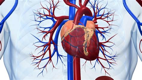 Cardiogenic Shock - Causes, Signs, Symptoms, Treatment