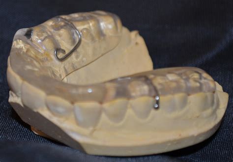 Bruxism/Nightguard - Dental Prosthetics Design Studio