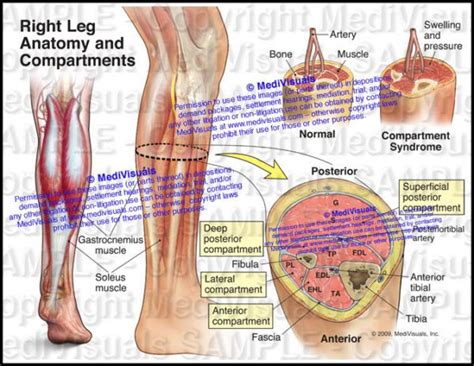 Anatomy and Compartments of the Right Leg (Compartment Syndrome) - Medivisuals Inc.