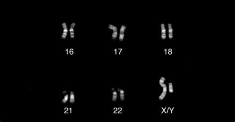 The Y Chromosome's Remaining Unsequenced Regions - The Atlantic