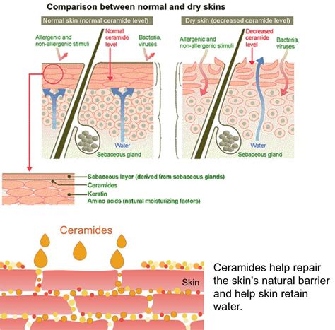 CeraVe - Moisturizing cream for eczema - Man's guide to eczema healing