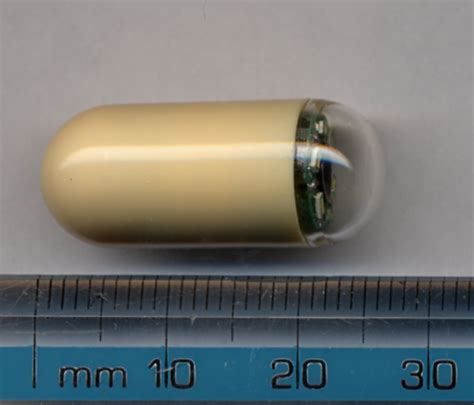 Capsule endoscopy - Wikipedia