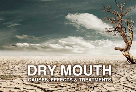 Dry Mouth Xerostomia Causes, Effects and Treatments - McOmie Dentistry