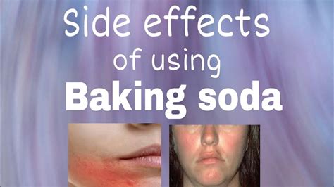 Side effects of using baking soda for beauty purposes. - YouTube