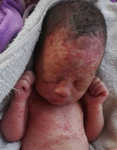 Newborn baby dumped in field found covered in ant and mosquito bites ...