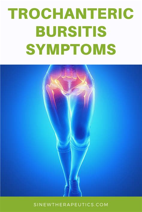 Pin on Trochanteric Bursitis
