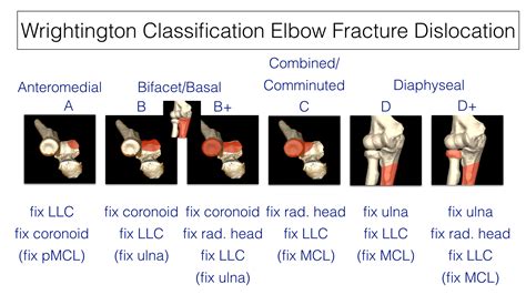 Wrightington-Classification.001 - ElbowDoc