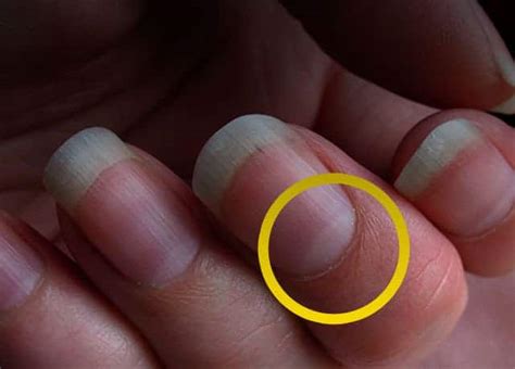 Lunula of Nails: What It Says About Your Health? – NailDesignCode