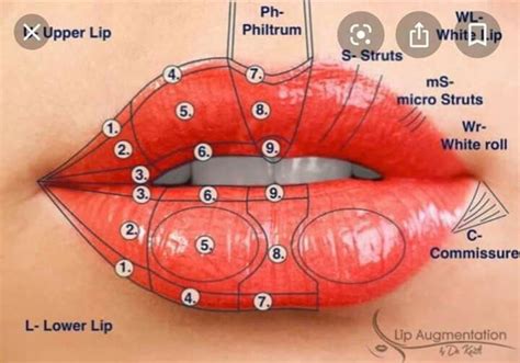 Pin by K. K. on beauty | Lip augmentation, Facial fillers, Dermal ...