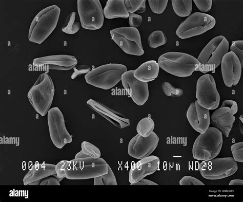 Cherry tree pollen under electron microscope Stock Photo - Alamy