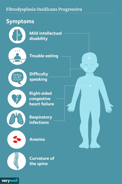 Fibrodysplasia Ossificans Progressiva: Symptoms, Treatment, and Diagnosis