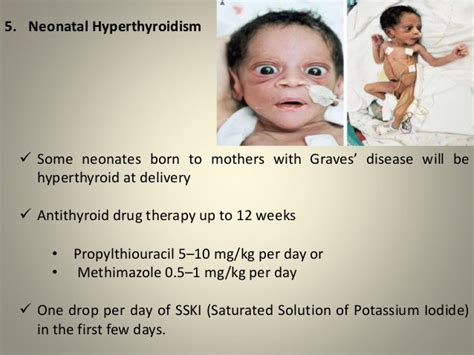 Thyroid disorders treatment