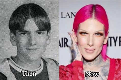 Jeffree Star Plastic Surgery Before and After Photos - Latest Plastic ...