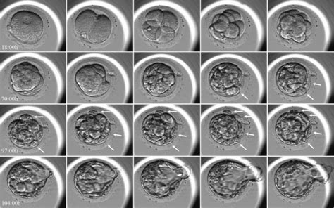 Time-lapse EmbryoScope™ photography of embryo expelling cell... | Download Scientific Diagram