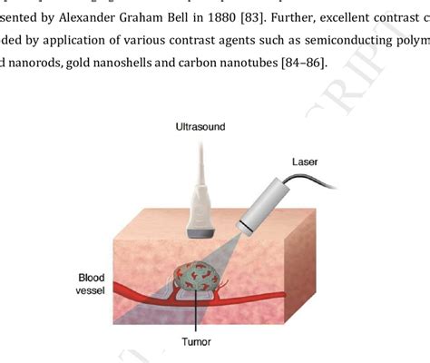 The principle of photoacoustic imaging is based on photoacoustic ...