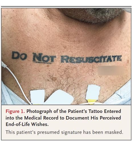 Unconscious Patient with a DNR Tattoo | Bioethics.net