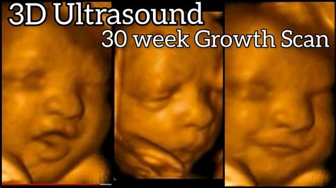 3D Ultrasound 30 weeks baby || Growth Scan || NT Scan || 30 week baby Movement || 3D Ultrasound ...