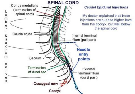 Types of nerve block used for relief of coccydynia