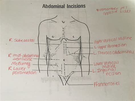 Autopsy Incision Diagram