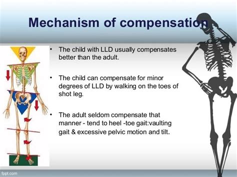 Limb length discrepency