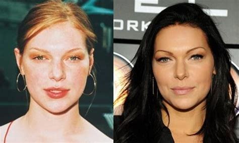 Laura Prepon before and after plastic surgery 3 – Celebrity plastic surgery online