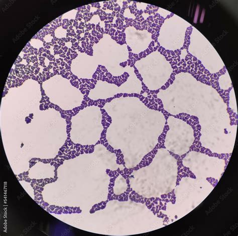 Real staphylococcus gram positive cocci shape bacteria under microscope ...