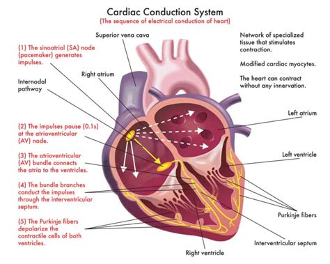 SVT medical terminology – key terms explained | Stop SVT