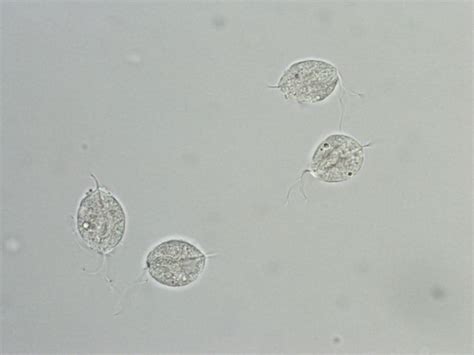 parasites in urine sediment