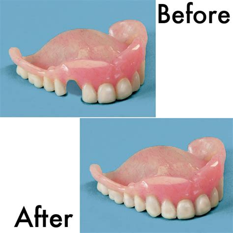 Denture Repair Kit - Denture Repair Kit With Teeth - Walter Drake