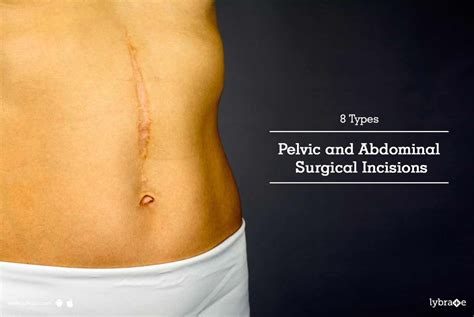 8 Types Pelvic And Abdominal Surgical Incisions By Dr - vrogue.co