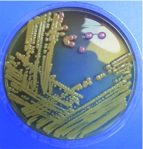 Fig. A2. Growth of lactose fermenter on MacConkey agar. | Download ...